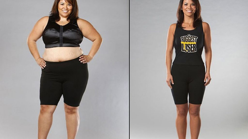 fotos antes y despues de reduccion de estomago
